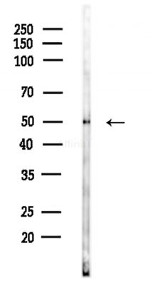 RBBP4 Antibody - Western blot analysis of lysates from Hela cells(heat-shock,45min treatment), using RBBP4 Antibody at 1/1000 dilution.