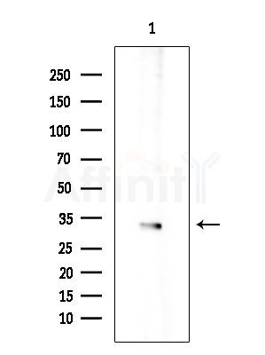 TIMP3 Antibody - Western blot analysis of extracts from Hela cells(LPS 4h treatment), using TIMP3 Antibody at 1/1000 dilution.