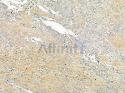 Collagen V  alpha 1 Antibody - DF6434 at 1/100 staining human normal placenta tissue by IHC-P.