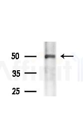 PSMC5 Antibody - Western blot analysis of lysates from various samples, using PSMC5 Antibody at 1/1000 dilution.