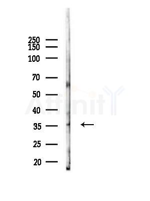 CDK6 Antibody - Western blot analysis of lysates from B16F10-LUC cells(starvation,24h treatment), using CDK6 Antibody at 1/1000 dilution.
