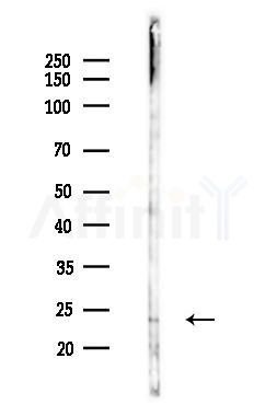 TNF beta Antibody - Western blot analysis of lysates from Hela cells(LPS 4h treatment), using TNF beta Antibody at 1/1000 dilution.