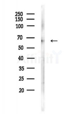 Factor IX/PTC Antibody - Western blot analysis of lysates from LoVo cells(heat-shock,45min treatment), using Factor IX/PTC Antibody at 1/1000 dilution.
