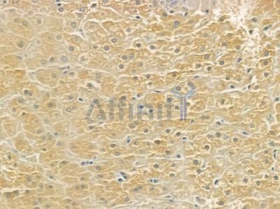 Renin Antibody - DF6480 at 1/100 staining human normal liver tissue by IHC-P.