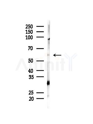 MYOC Antibody - Western blot analysis of lysates from MDA-MB-231 cells(heat-shock,45min treatment), using MYOC Antibody at 1/1000 dilution.