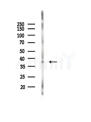 SULT1A1 Antibody - Western blot analysis of lysates from Mouse liver, using SULT1A1 Antibody at 1/1000 dilution.