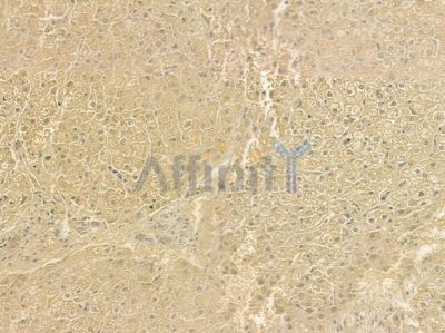 HAMP Antibody - DF6492 at 1/100 staining human normal liver tissue by IHC-P.