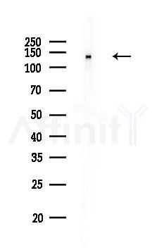 ERCC5 Antibody - Western blot analysis of lysates from COLO205 cells, using ERCC5 Antibody at 1/1000 dilution.