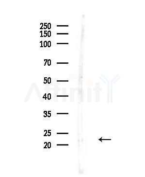 DHFR Antibody - Western blot analysis of lysates from Hela cells(UV,30min treatment), using DHFR Antibody at 1/1000 dilution.