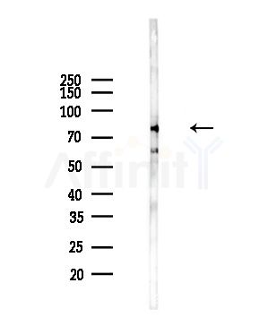 TAP2 Antibody - Western blot analysis of lysates from Hela cells(heat-shock,45min treatment), using TAP2 Antibody at 1/1000 dilution.