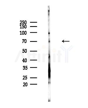 TAP2 Antibody - Western blot analysis of lysates from PC12 cells(starvation,24h treatment), using TAP2 Antibody at 1/1000 dilution.