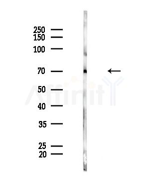 TAP2 Antibody - Western blot analysis of lysates from Mouse brain, using TAP2 Antibody at 1/1000 dilution.