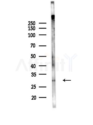 HLA-DRB3 Antibody - Western blot analysis of lysates from Hela cells(starvation,24h treatment), using HLA-DRB3 Antibody at 1/1000 dilution.