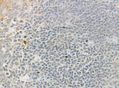 IL23R Antibody - DF6501 at 1/100 staining human normal tonsil tissue by IHC-P.