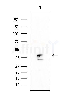 CSNK2A2 Antibody - Western blot analysis of extracts from HUVEC cells, using CSNK2A2 Antibody at 1/1000 dilution.