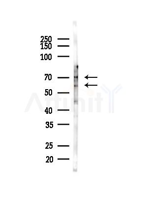 KPNA2 Antibody - Western blot analysis of lysates from COLO205 cells(heat-shock,45min treatment), using KPNA2 Antibody at 1/1000 dilution.