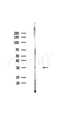 TFPI Antibody - Western blot analysis of lysates from HUVEC cells(UV,30min treatment), using TFPI Antibody at 1/1000 dilution.