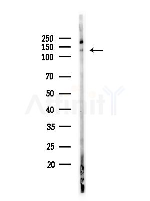 RFC1 Antibody - Western blot analysis of lysates from Hela cells(heat-shock,45min treatment), using RFC1 Antibody at 1/1000 dilution.