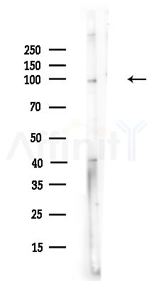 Insulin degrading enzyme/IDE Antibody - Western blot analysis of lysates from A375 cells(heat-shock,45min treatment), using Insulin degrading enzyme/IDE Antibody at 1/1000 dilution.