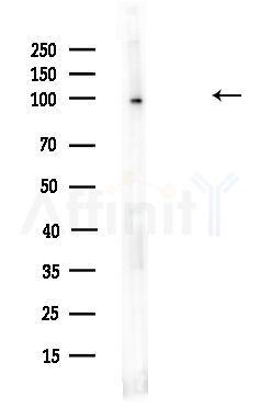 Insulin degrading enzyme/IDE Antibody - Western blot analysis of lysates from HUVEC cells(UV,30min treatment), using Insulin degrading enzyme/IDE Antibody at 1/1000 dilution.