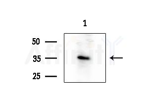 DTNBP1 Antibody - Western blot analysis of extracts from COLO205 cells, using DTNBP1 Antibody at 1/1000 dilution.
