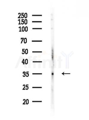 DTNBP1 Antibody - Western blot analysis of lysates from COLO205 cells, using DTNBP1 Antibody at 1/1000 dilution.