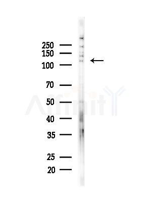 RASA1 Antibody - Western blot analysis of lysates from PC12 cells(starvation,24h treatment), using RASA1 Antibody at 1/1000 dilution.