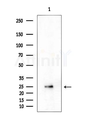 Cathelicidin Antibody - Western blot analysis of extracts from HepG2 cells, using Cathelicidin Antibody at 1/1000 dilution.