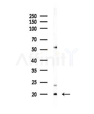 Cathelicidin Antibody - Western blot analysis of lysates from HepG2 cells, using Cathelicidin Antibody at 1/1000 dilution.