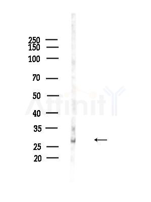 SFRS1 Antibody - Western blot analysis of lysates from A375 cells(heat-shock,45min treatment), using SFRS1 Antibody at 1/1000 dilution.