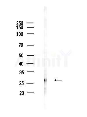 SFRS1 Antibody - Western blot analysis of lysates from HepG2 cells(heat-shock,45min treatment), using SFRS1 Antibody at 1/1000 dilution.
