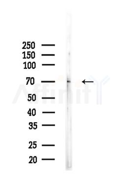 BTRC Antibody - Western blot analysis of lysates from Mouse brain, using BTRC Antibody at 1/1000 dilution.
