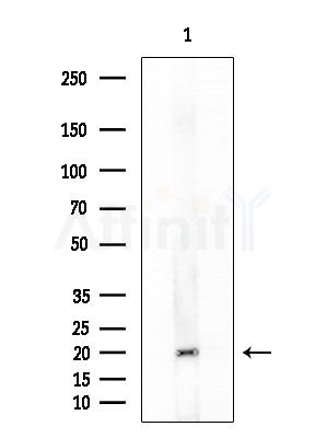 Substance P Antibody - Western blot analysis of lysates from Mouse testis, using Substance P Antibody at 1/1000 dilution.