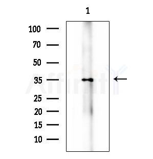 AKR1B1 Antibody - Western blot analysis of extracts from Hela cells(LPS 4h treatment), using AKR1B1 Antibody at 1/1000 dilution.