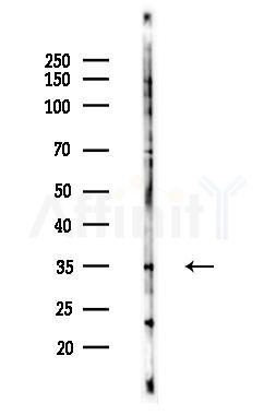 AKR1B1 Antibody - Western blot analysis of lysates from Hela cells(LPS 4h treatment), using AKR1B1 Antibody at 1/1000 dilution.