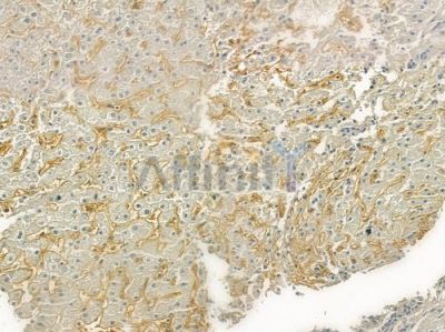 Factor XII Antibody - DF6558 at 1/100 staining human normal liver tissue by IHC-P.