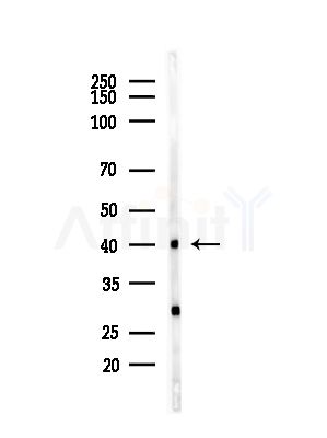 KIR2DL1 Antibody - Western blot analysis of lysates from B16F10-LUC cells(starvation,24h treatment), using KIR2DL1 Antibody at 1/1000 dilution.