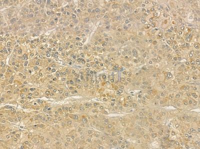 KIR2DL1 Antibody - DF6560 at 1/100 staining rat lung tissue by IHC-P.
