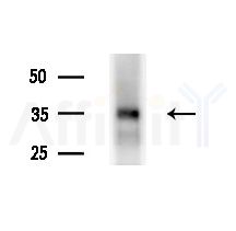 KIR2DL3 Antibody - Western blot analysis of lysates from HepG2 cells(LPS, 4h treatment), using KIR2DL3 Antibody at 1/1000 dilution.