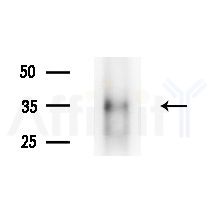 KIR2DL3 Antibody - Western blot analysis of lysates from PC12 cells(starvation,24h treatment), using KIR2DL3 Antibody at 1/1000 dilution.