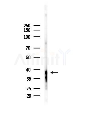KIR2DL3 Antibody - Western blot analysis of lysates from PC12 cells(starvation,24h treatment), using KIR2DL3 Antibody at 1/1000 dilution.