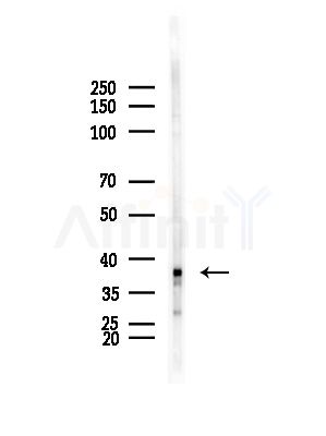 KIR2DL3 Antibody - Western blot analysis of lysates from HepG2 cells(LPS, 4h treatment), using KIR2DL3 Antibody at 1/1000 dilution.