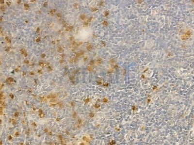 CD66/CEACAM1 Antibody - DF6564 at 1/100 staining human normal tonsil tissue by IHC-P.