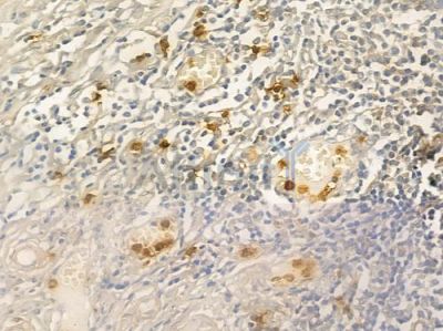 CD66/CEACAM1 Antibody - DF6564 at 1/100 staining human normal tonsil tissue by IHC-P.