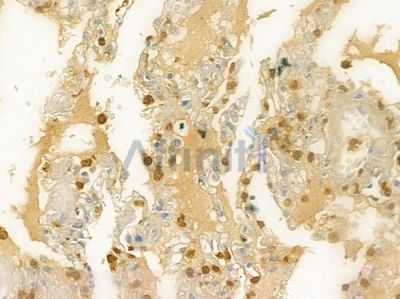 CD66/CEACAM1 Antibody - DF6564 at 1/100 staining human normal lung tissue by IHC-P.