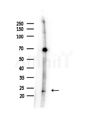 CD9 Antibody - Western blot analysis of lysates from LoVo cells(heat-shock,45min treatment), using CD9 Antibody at 1/1000 dilution.