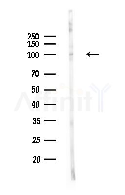 WFS1 Antibody - Western blot analysis of lysates from PC12 cells(UV,30min treatment), using WFS1 Antibody at 1/1000 dilution.