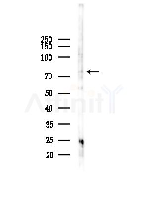Factor B/CFB Antibody - Western blot analysis of lysates from RAW264.