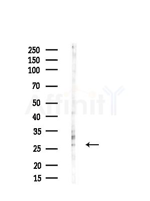 IGFBP5 Antibody - Western blot analysis of lysates from HUVEC cells(starvation,24h treatment), using IGFBP5 Antibody at 1/1000 dilution.