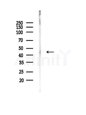 CHI3L1 Antibody - Western blot analysis of lysates from A375 cells(heat-shock, 45min treatment), using CHI3L1 Antibody at 1/1000 dilution.